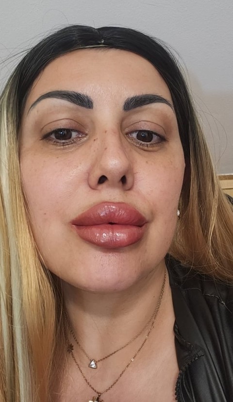 REALA NOUA aici SANI nr 5.botox 1 70 cm .35 ani .matura Parc Lake Titan..Strada Baba Novac nr 19 A - imagine 134716