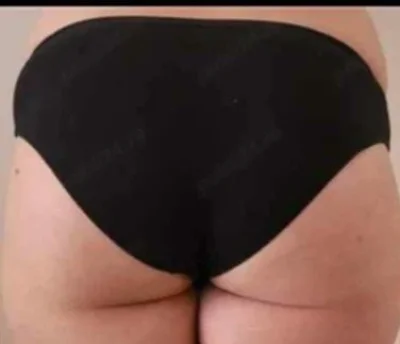 Drumul timonerul 7,9 blocul 104 și scara 1